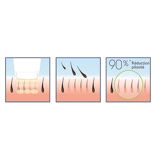 Babyliss Homelight 100 G934E Işık Bazlı Epilatör